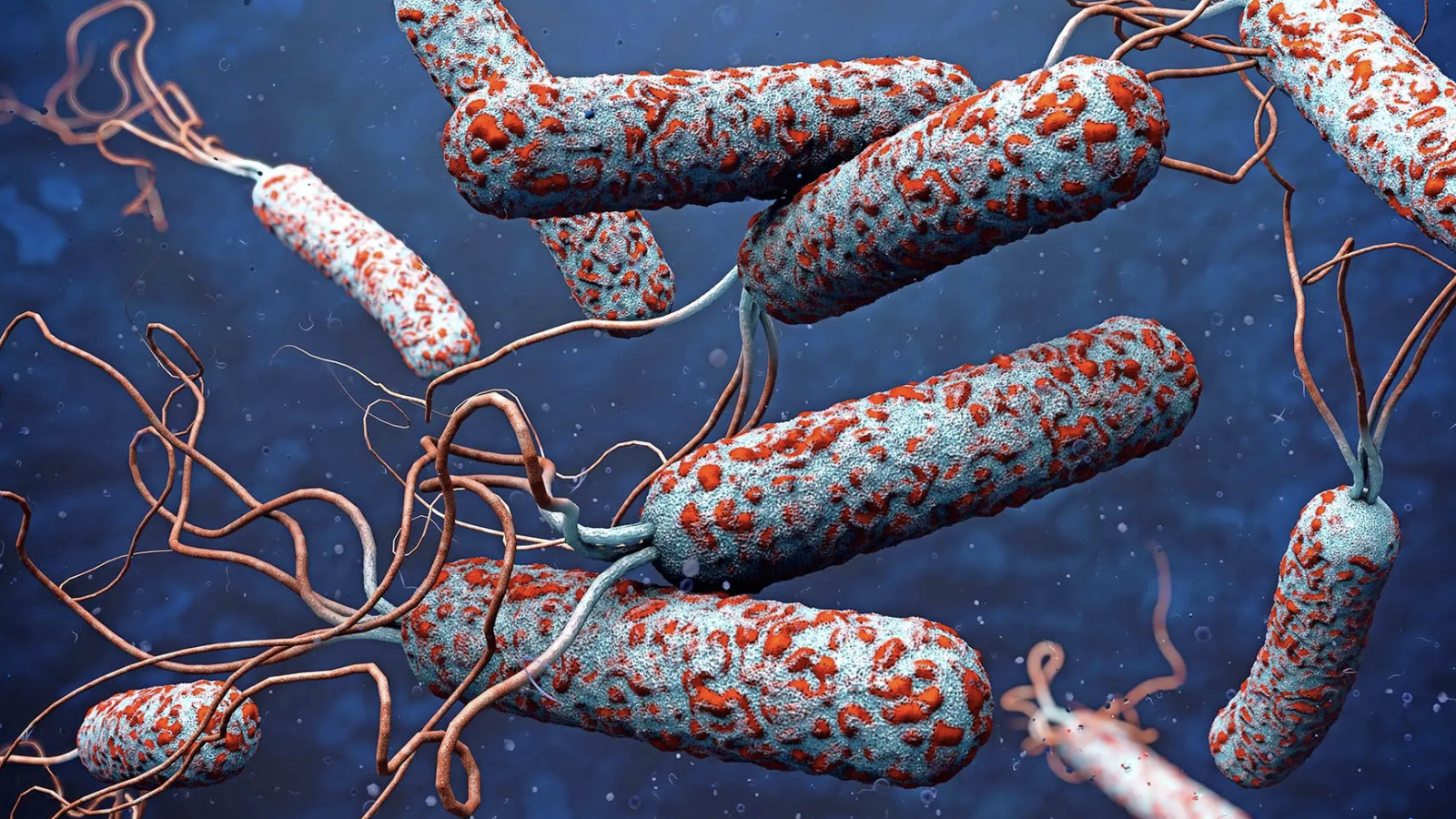 dso alarm verdi 31 ulkede kolera salgini agirlasti FKGJqbyE