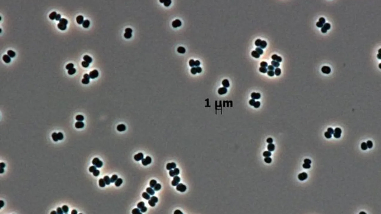 olu taklidi yapan super bakteriler uzayi bile tehdit ediyor UAMPdtua.jpg