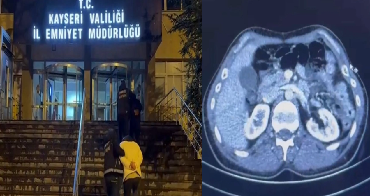 İranlı şüphelilerin midelerinden uyuşturucu çıktı