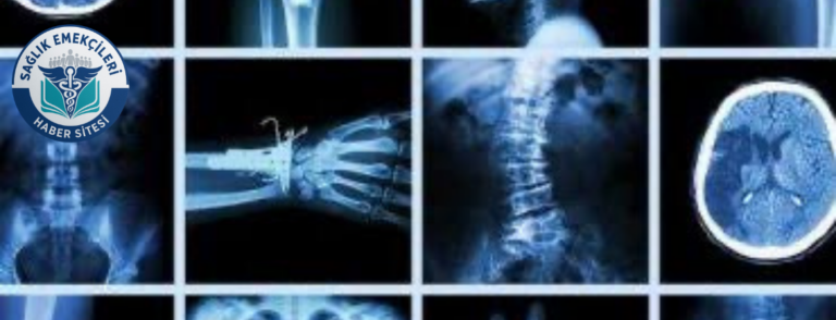 radyoloji-skandali-iddiasi-savcilik-harekete-gecti-yanlis-raporlar-mercek-altinda-saglik-emekcileri-haber-kanali-QdTJ4fuT.png